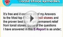 What antibiotics do I need to take for tonsil stones?